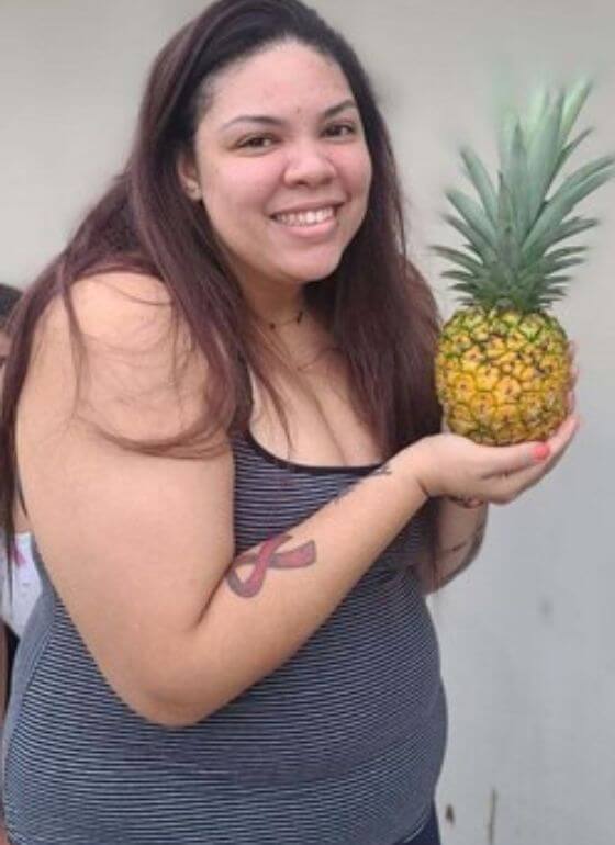 An obese woman holding a pineapple in front of a wall, before starting treatment her PCOS Weight Loss Treatment