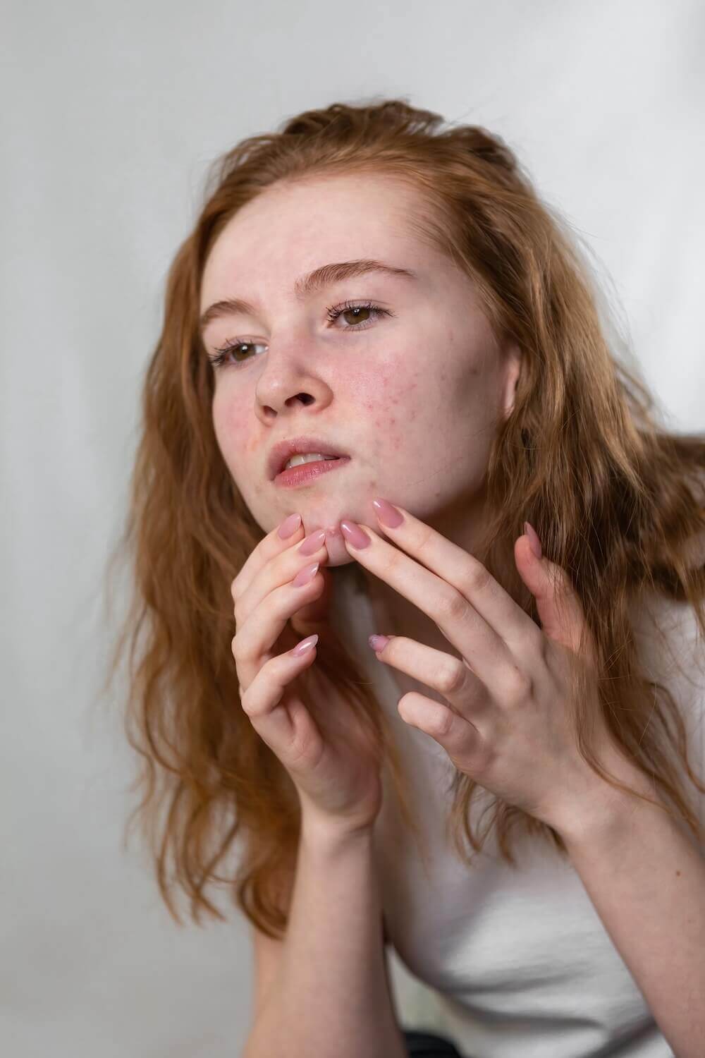 PCOS Sisters A woman with red hair is putting her hand on her face, possibly due to acne.